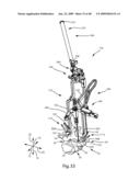 SURGICAL MEASUREMENT AND RESECTION FRAMEWORK diagram and image