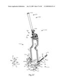 SURGICAL MEASUREMENT AND RESECTION FRAMEWORK diagram and image