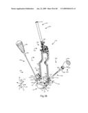 SURGICAL MEASUREMENT AND RESECTION FRAMEWORK diagram and image