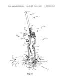 SURGICAL MEASUREMENT AND RESECTION FRAMEWORK diagram and image