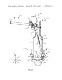 SURGICAL MEASUREMENT AND RESECTION FRAMEWORK diagram and image