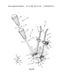 SURGICAL MEASUREMENT AND RESECTION FRAMEWORK diagram and image