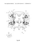 SURGICAL MEASUREMENT AND RESECTION FRAMEWORK diagram and image