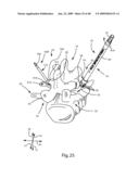 SURGICAL MEASUREMENT SYSTEMS AND METHODS diagram and image