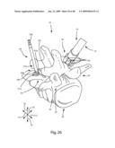 SURGICAL MEASUREMENT SYSTEMS AND METHODS diagram and image