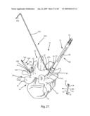 SURGICAL MEASUREMENT SYSTEMS AND METHODS diagram and image