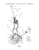 SURGICAL MEASUREMENT SYSTEMS AND METHODS diagram and image