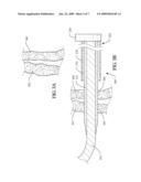 RIVET INTRODUCTION SYSTEM diagram and image