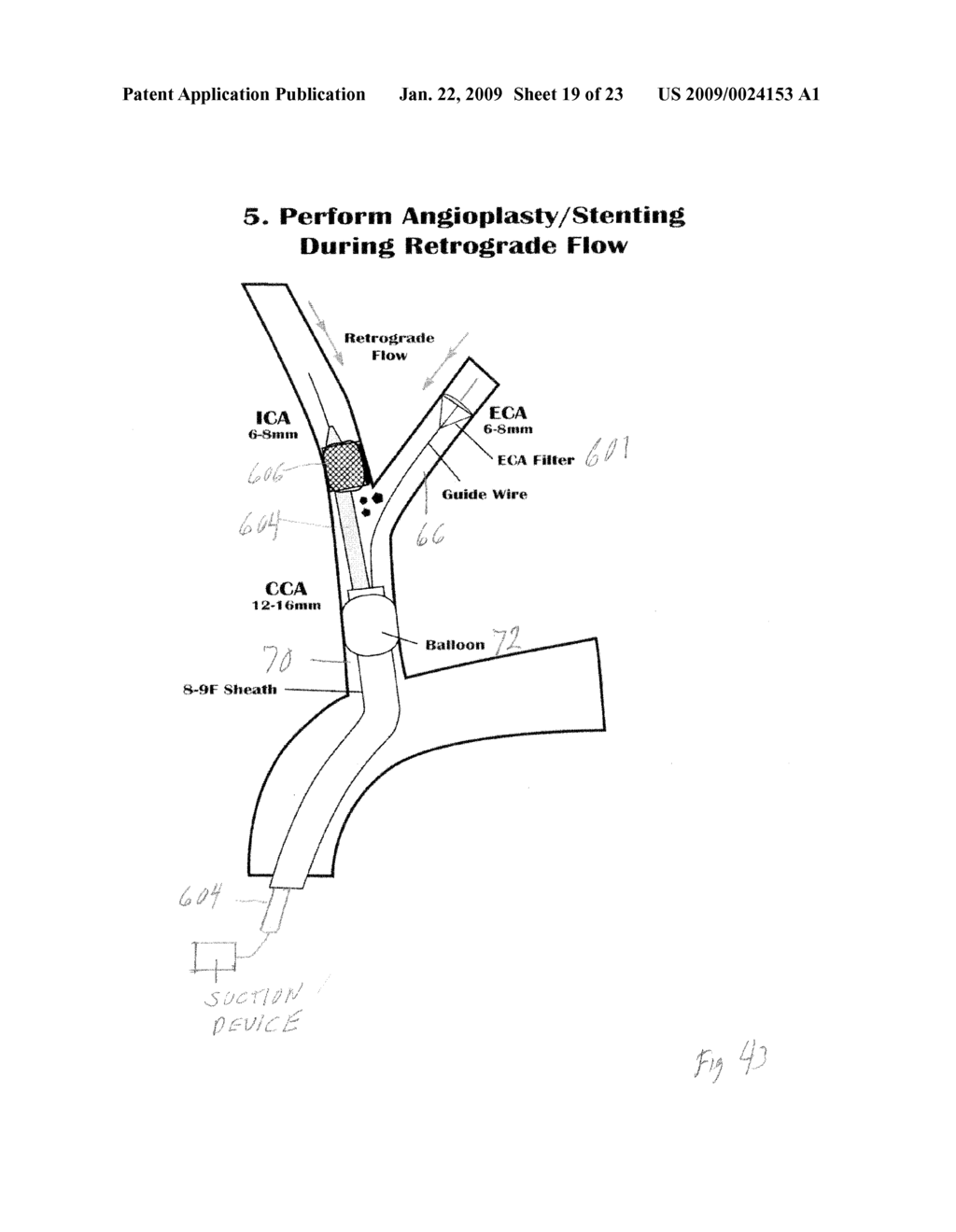 VASCULAR FILTER WITH IMPROVED STRENGTH AND FLEXIBILTY - diagram, schematic, and image 20