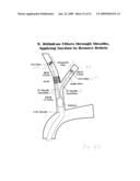 VASCULAR FILTER WITH IMPROVED STRENGTH AND FLEXIBILTY diagram and image