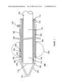 Tissue Dissection Method diagram and image