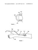 Tissue Dissection Method diagram and image