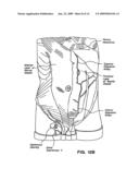 Tissue Dissection Method diagram and image