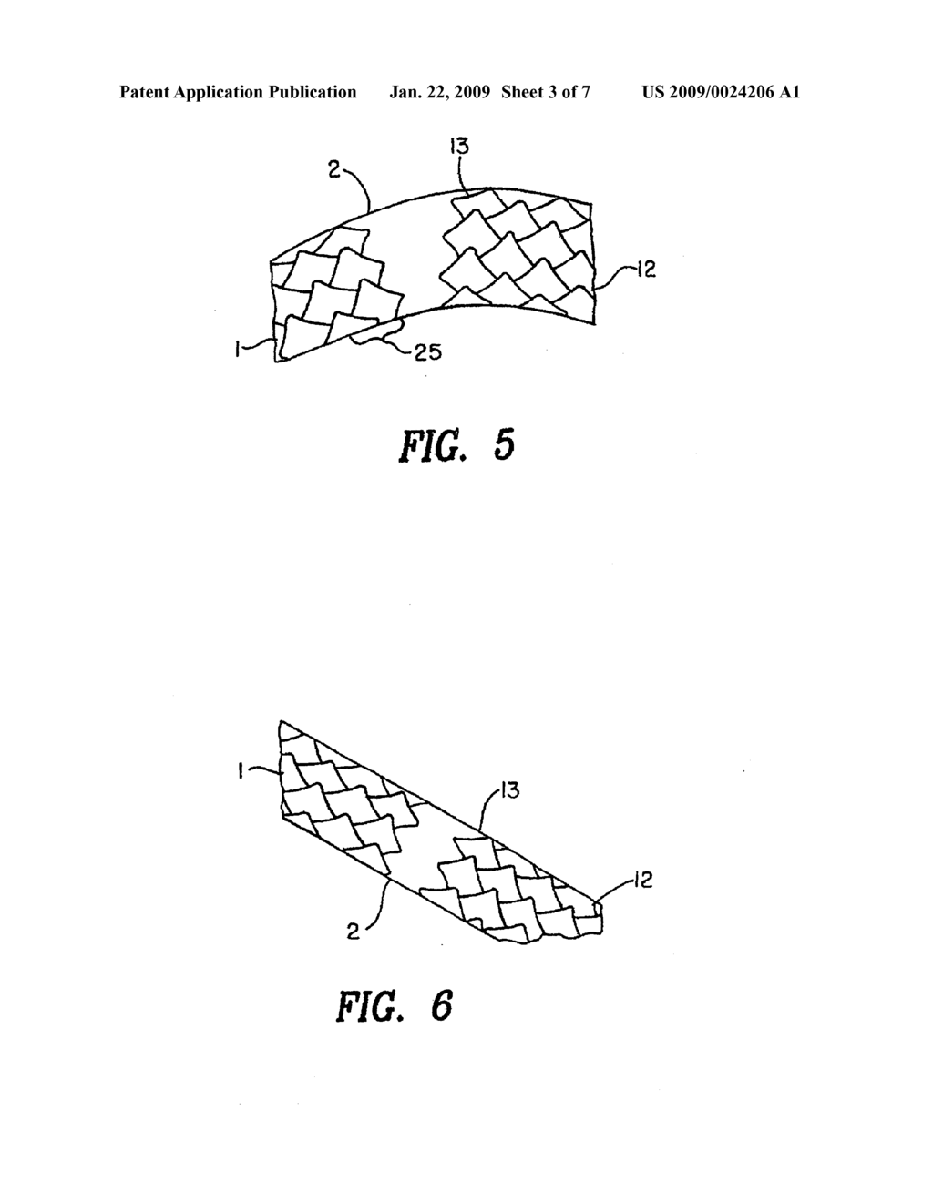 STENT WITH VARIABLE FEATURES TO OPTIMIZE SUPPORT AND METHOD OF MAKING SUCH STENT - diagram, schematic, and image 04