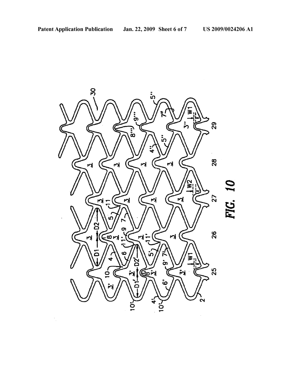 STENT WITH VARIABLE FEATURES TO OPTIMIZE SUPPORT AND METHOD OF MAKING SUCH STENT - diagram, schematic, and image 07