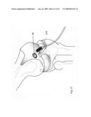 Crafting of cartilage diagram and image