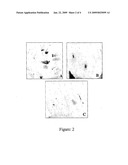 METHODS FOR PLANT REGENERATION, TRANSFORMATION AND PRODUCTION OF INSECT RESISTANT TRANSGENIC OKRA diagram and image