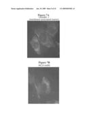 CHARACTERIZATION OF A MEMBRANE ESTROGEN RECEPTOR diagram and image