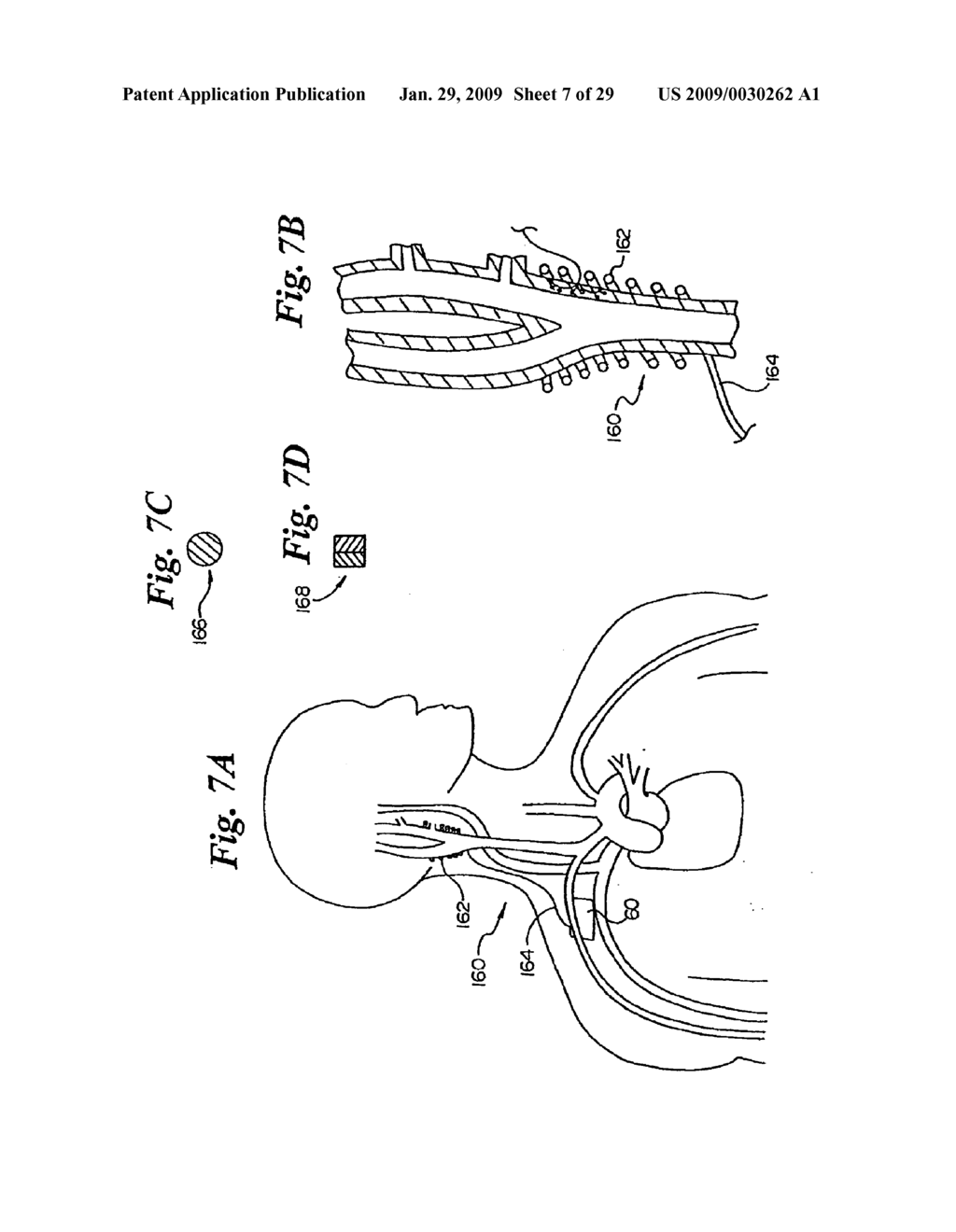 BAROREFLEX ACTIVATION FOR SEDATION AND SLEEP - diagram, schematic, and image 08