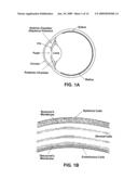 ACCURATE DETERMINATION OF INTRAOCULAR PRESSURE AND CHARACTERIZATION OF MECHANICAL PROPERTIES OF THE CORNEA diagram and image