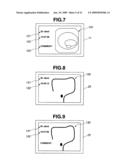 Endoscope Shape Detecting Apparatus diagram and image