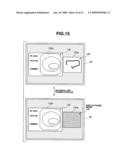 Endoscope Shape Detecting Apparatus diagram and image