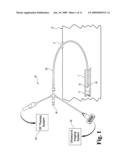 IMAGE-GUIDED INTRAVASCULAR THERAPY CATHETERS diagram and image