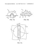 ACCESS GUIDE AND METHODS OF USING THE SAME diagram and image