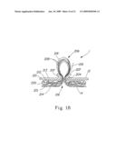 Absorbent article diagram and image