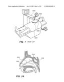 Methods and devices for facilitating visualization in a surgical environment diagram and image