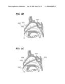 Methods and devices for facilitating visualization in a surgical environment diagram and image