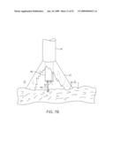 VISUAL ELECTRODE ABLATION SYSTEMS diagram and image