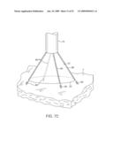 VISUAL ELECTRODE ABLATION SYSTEMS diagram and image