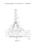 VISUAL ELECTRODE ABLATION SYSTEMS diagram and image