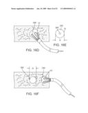 VISUAL ELECTRODE ABLATION SYSTEMS diagram and image