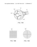 VISUAL ELECTRODE ABLATION SYSTEMS diagram and image