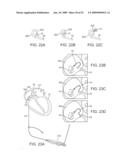 VISUAL ELECTRODE ABLATION SYSTEMS diagram and image