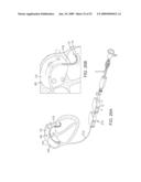 VISUAL ELECTRODE ABLATION SYSTEMS diagram and image