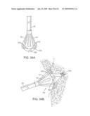 VISUAL ELECTRODE ABLATION SYSTEMS diagram and image