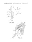 VISUAL ELECTRODE ABLATION SYSTEMS diagram and image