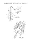 VISUAL ELECTRODE ABLATION SYSTEMS diagram and image