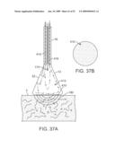 VISUAL ELECTRODE ABLATION SYSTEMS diagram and image