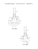 VISUAL ELECTRODE ABLATION SYSTEMS diagram and image