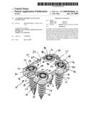 Anterior vertebral plate with suture lock diagram and image