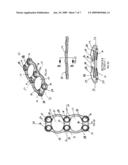 Anterior vertebral plate with suture lock diagram and image