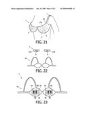 BODY COVER, GLASSES AND/OR AT LEAST PARTIAL HEAD COVER, METHOD FOR RADIATING AT LEAST PART OF A HUMAN BODY AND USE OF A BODY COVER diagram and image