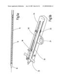 INSERTION SYSTEM FOR STENTS, COMPRISING TENSION-COMPRESSION KINEMATICS diagram and image