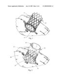 Socket For Fenestrated Tubular Prosthesis diagram and image