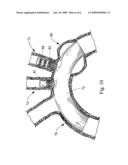 Socket For Fenestrated Tubular Prosthesis diagram and image