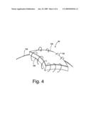 COLLAGEN DEVICE AND METHOD OF PREPARING THE SAME diagram and image